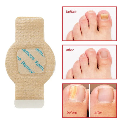 Nagelvital™ Effektive Hilfe gegen Nagelpilz