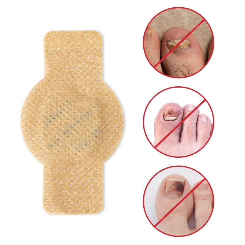 Nagelvital™ Effektive Hilfe gegen Nagelpilz
